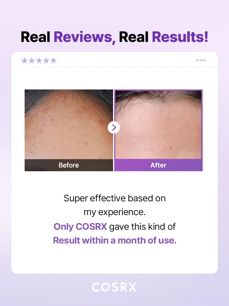 COSRX AHA/BHA Clarifying Treatment Toner — imej 6